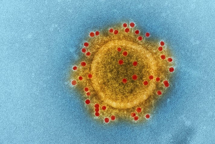 microscopic shot of a virus
